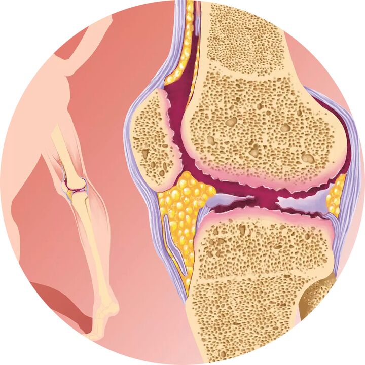 Hondroten – Támogatja az ízületek mozgékonyságát