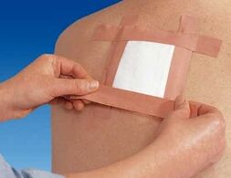 Terápiás tapasz használata hátfájásra